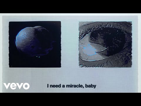 Nothing But Thieves - Miracle, Baby | Musik | Was is hier eigentlich los?